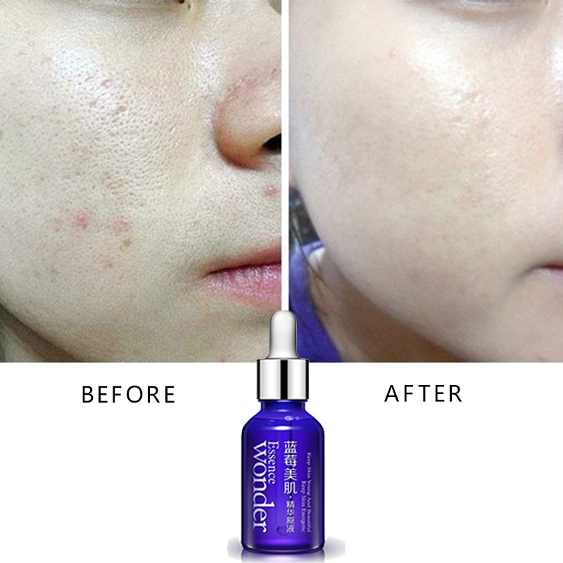 BIOAQUA Blueberry Face Lifting - Skincare Garnier recension och pris