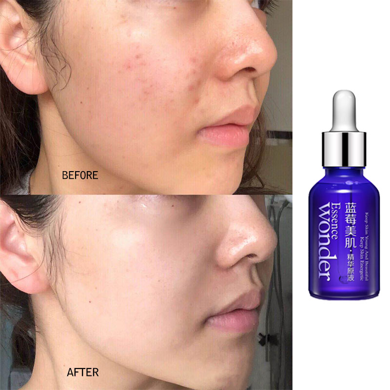 BIOAQUA Blueberry Face Lifting - Skincare Garnier recension och pris