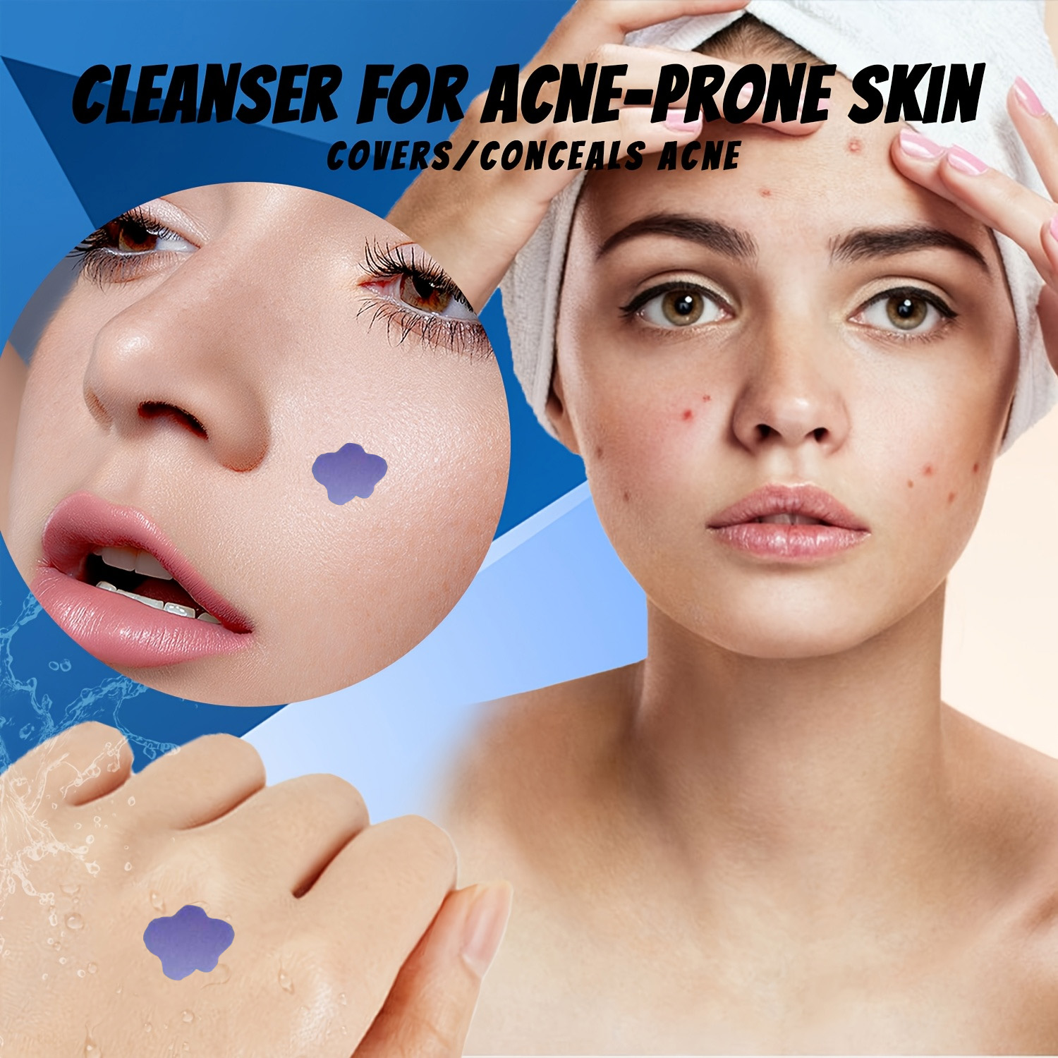 Microneedle Acne Pimple Patch  - Skincare You recension och pris