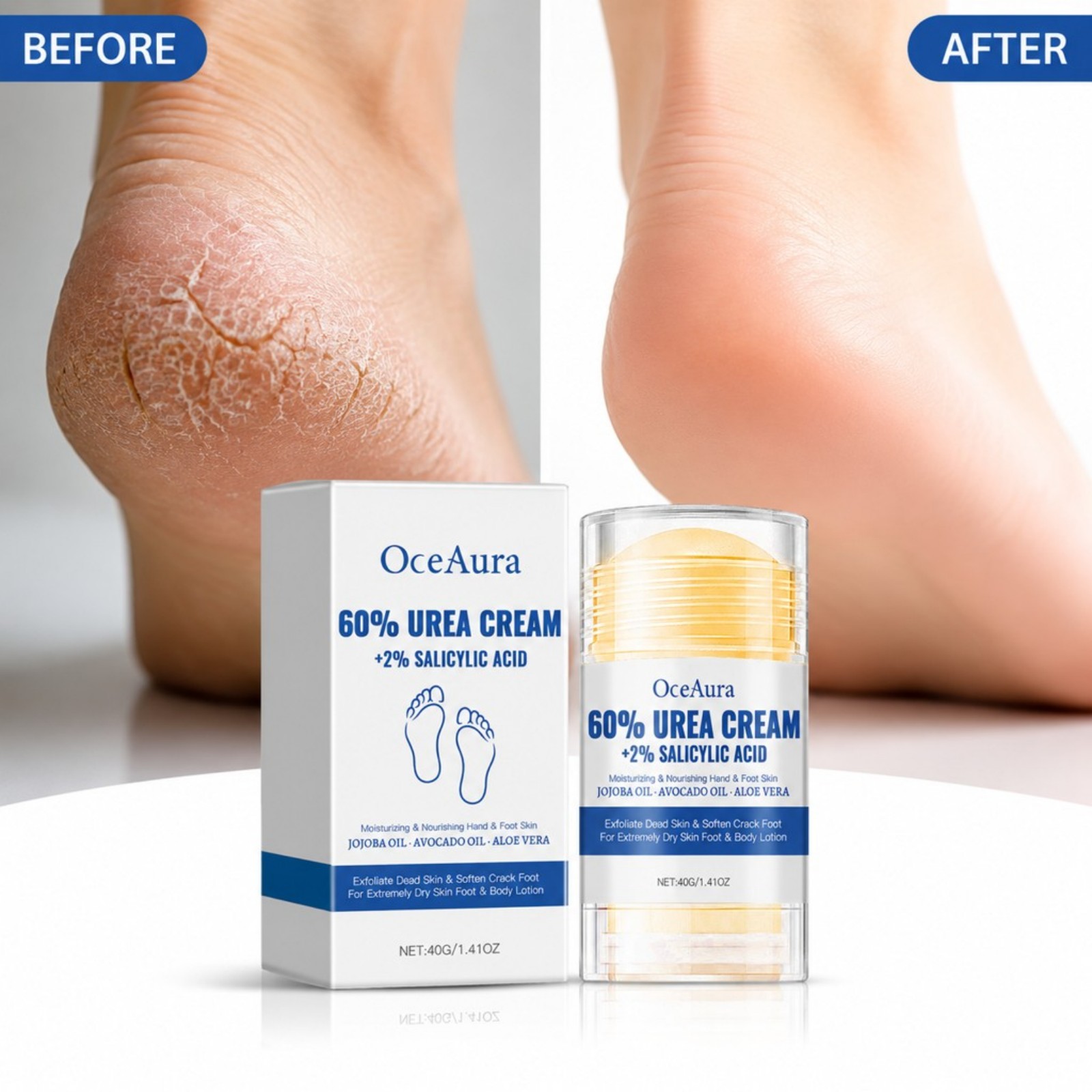 60% Urea Foot Care Cream Stick - Urea Foot Cream recension och pris
