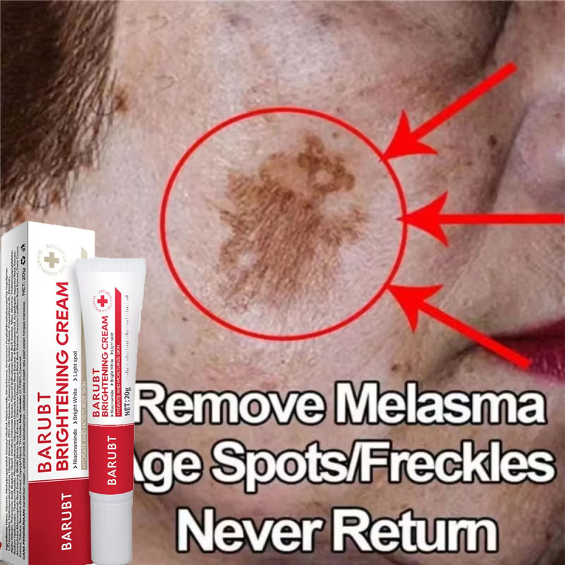 Powerful Spot-removing Whiteni - Skincare Vitamin C recension och pris