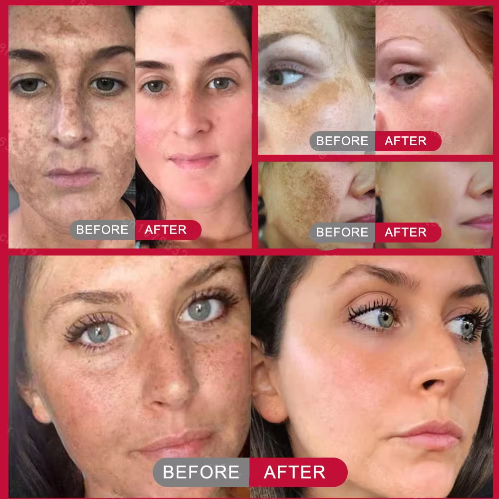 Powerful Spot-removing Whiteni - Skincare Vitamin C recension och pris