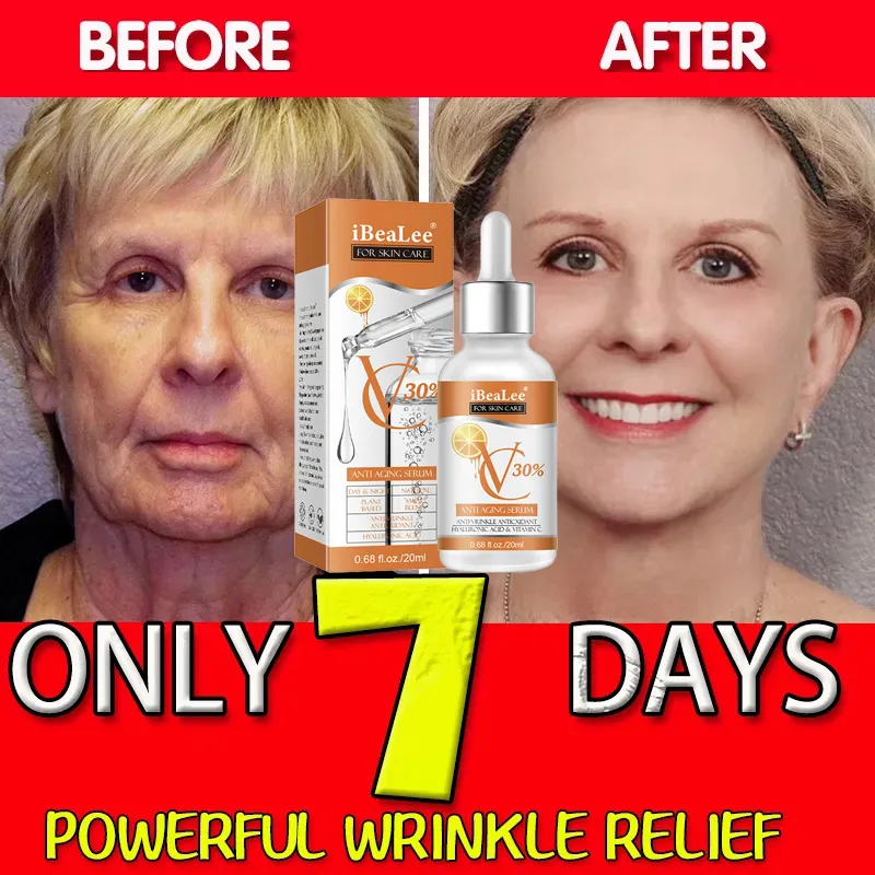 Premium 30% Vitamin C Serum Fo - Skincare Garnier recension och pris