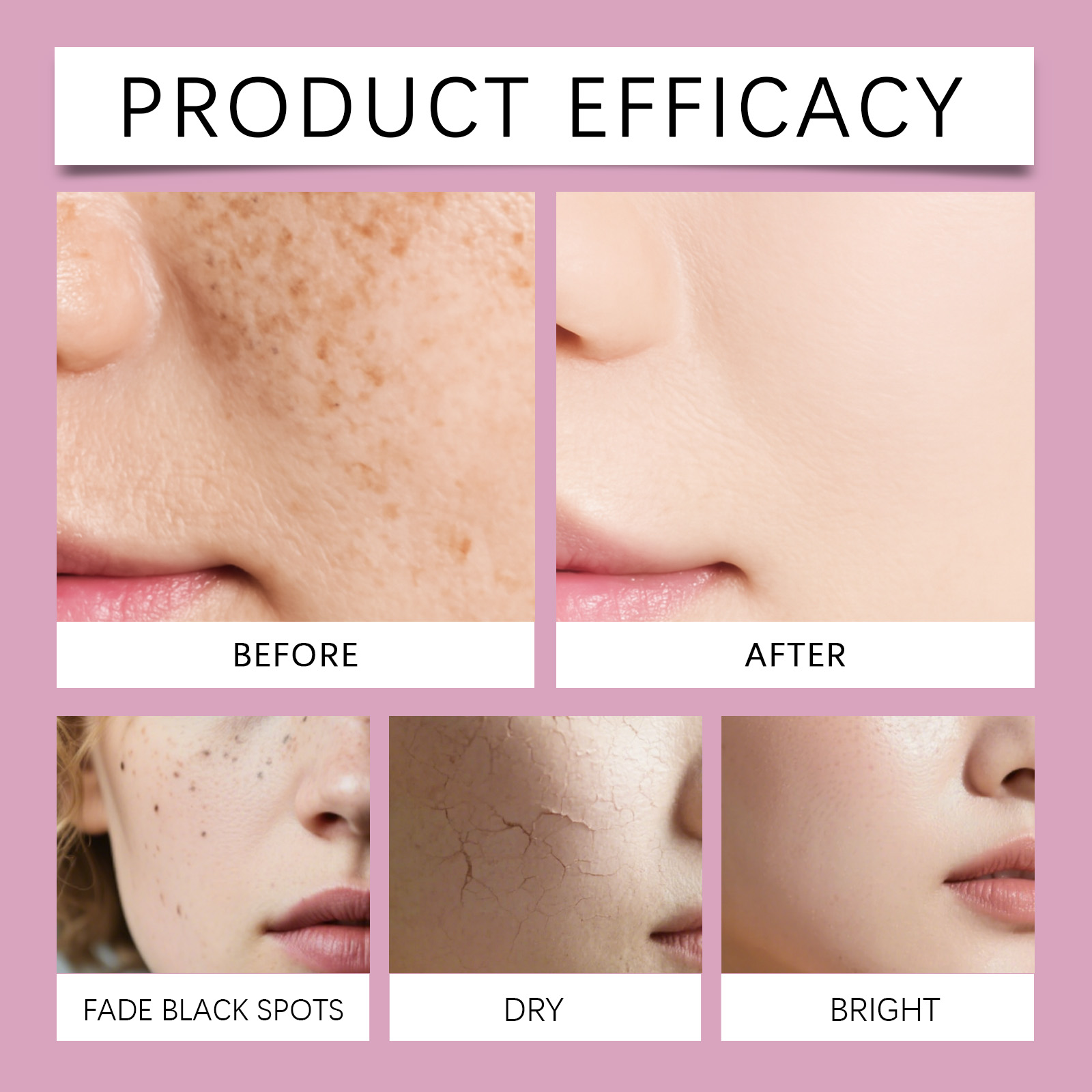 Korean Calcium Collagen Skinca - Skincare Niacinamide recension och pris