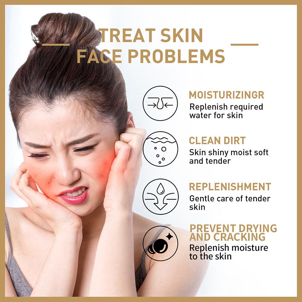 Rice Face Toner Moisturizing H - Skincare Garnier recension och pris