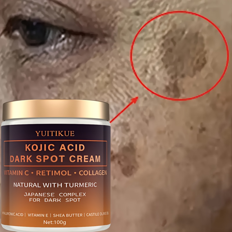 Arbutin fading cream, Vitamin  - Skincare Vitamin C recension och pris